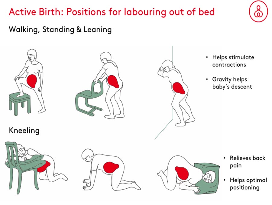 Active birth: Positions for labouring out of bed